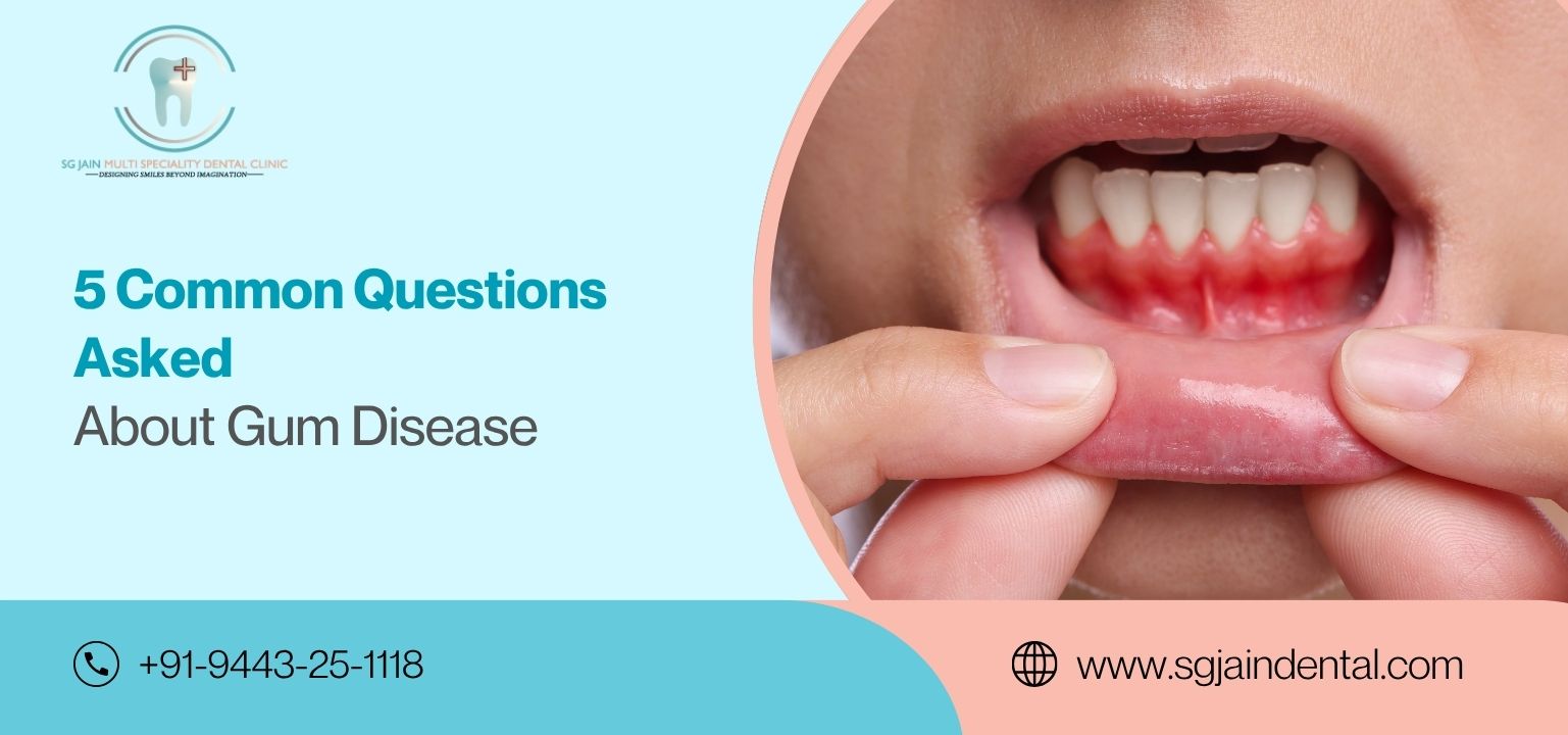 5 Common Questions to Ask a Gum Specialist About Gum Disease