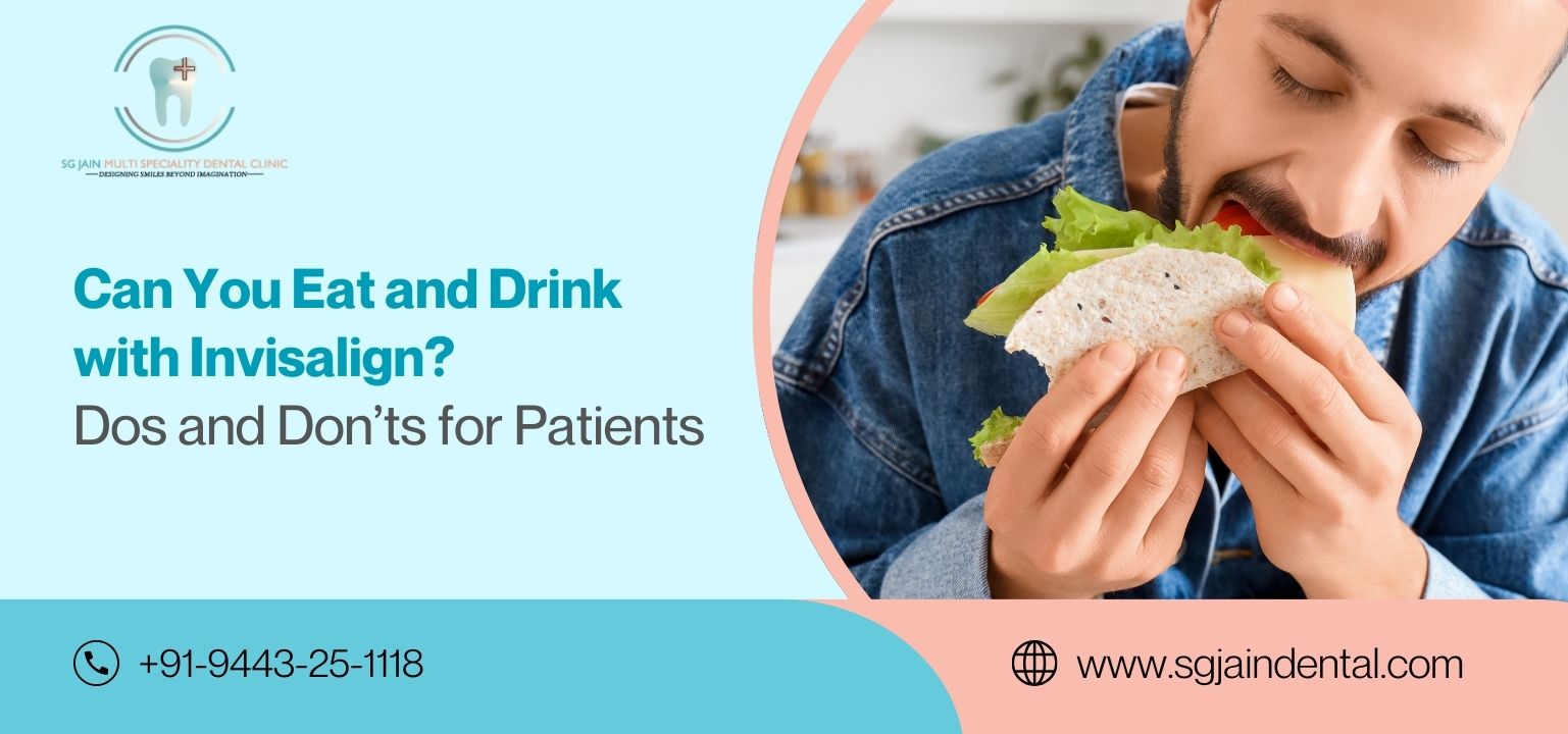 Can You Eat and Drink with Invisalign? Dos and Don’ts for Patients