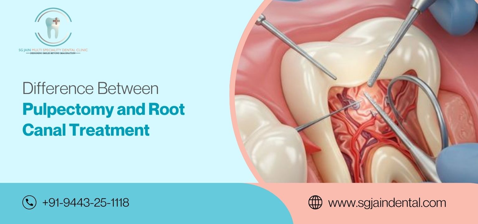 Pulpectomy and Root Canal Treatment