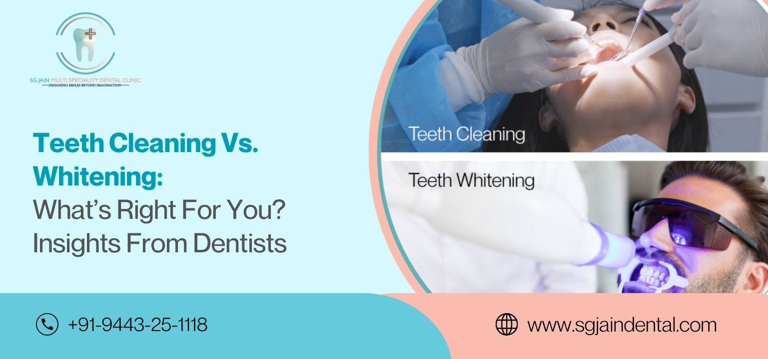 Teeth Cleaning Vs Whitening Whats Right For You Insights From Dentists