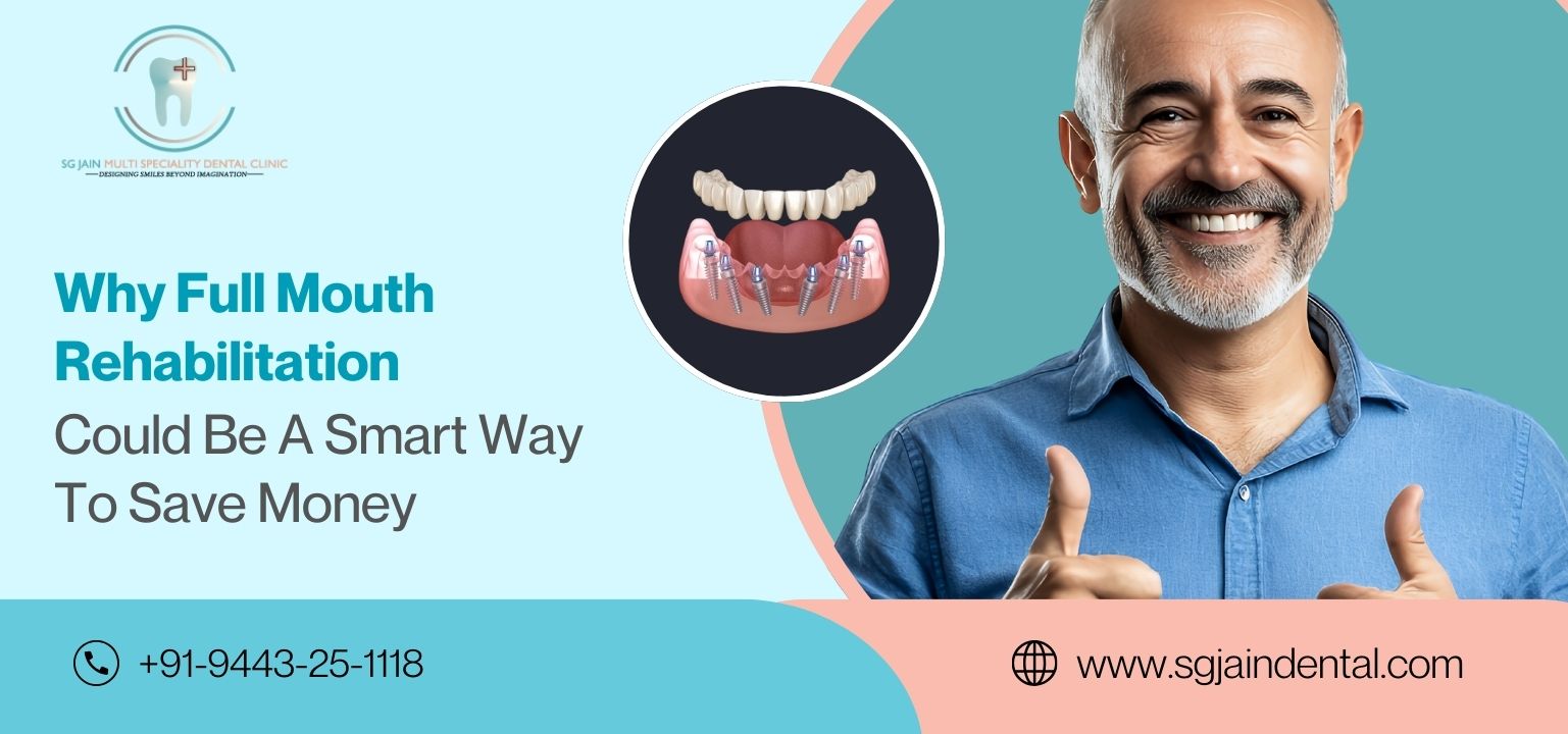 Why Full Mouth Rehabilitation Could Be a Smart Way to Save Money